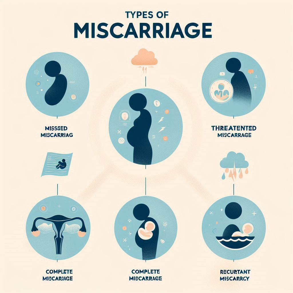 visually represents the types of miscarriages. What are the most common causes of miscarriage